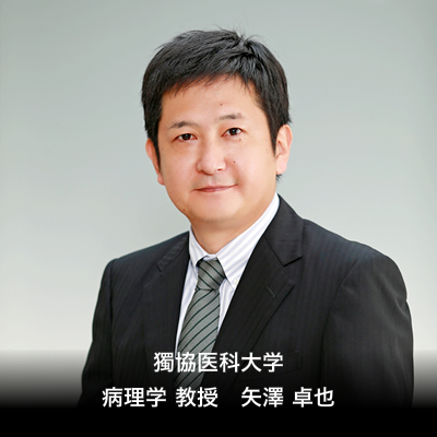 獨協医科大学 病理学 教授 矢澤 卓也