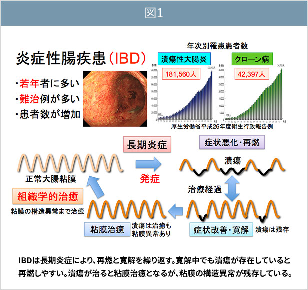 炎症 性 腸 疾患 に関する 記述 で ある