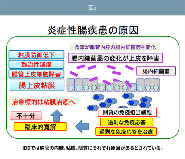 炎症 性 腸 疾患 に関する 記述 で ある